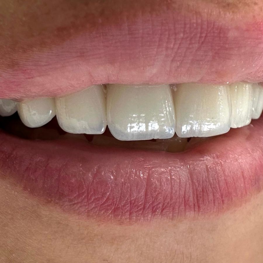 Naši radovi — Dentana Pro