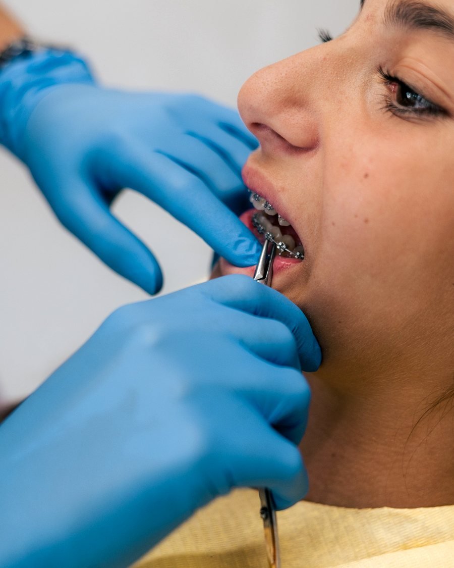 Ortodoncija — Dentana Pro