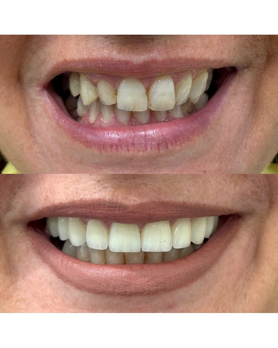 Protetika — Dentana Pro