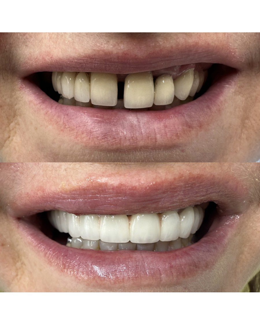 Protetika — Dentana Pro