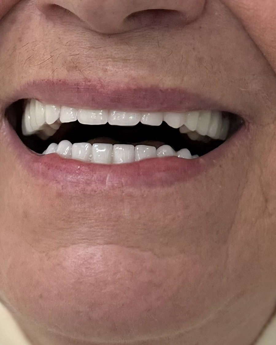 Protetika — Dentana Pro