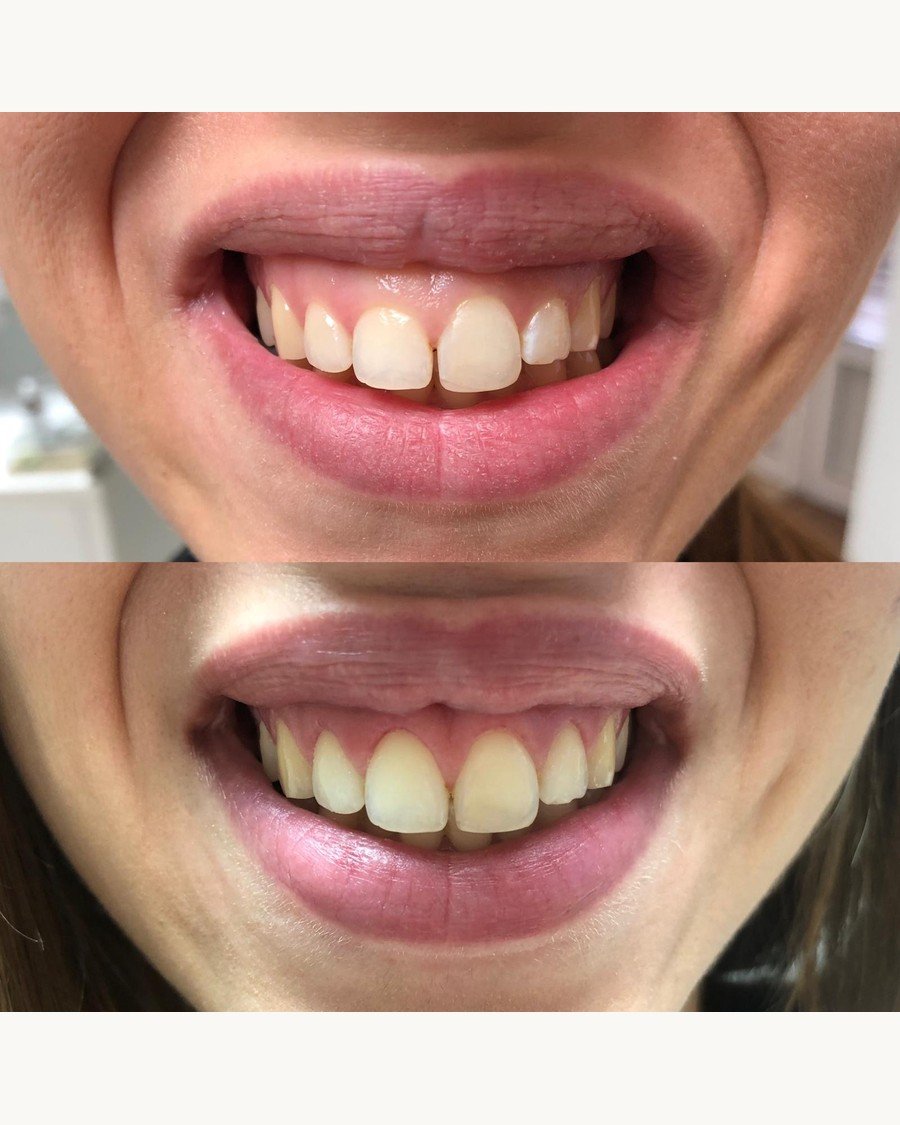 Parodontologija — Dentana Pro