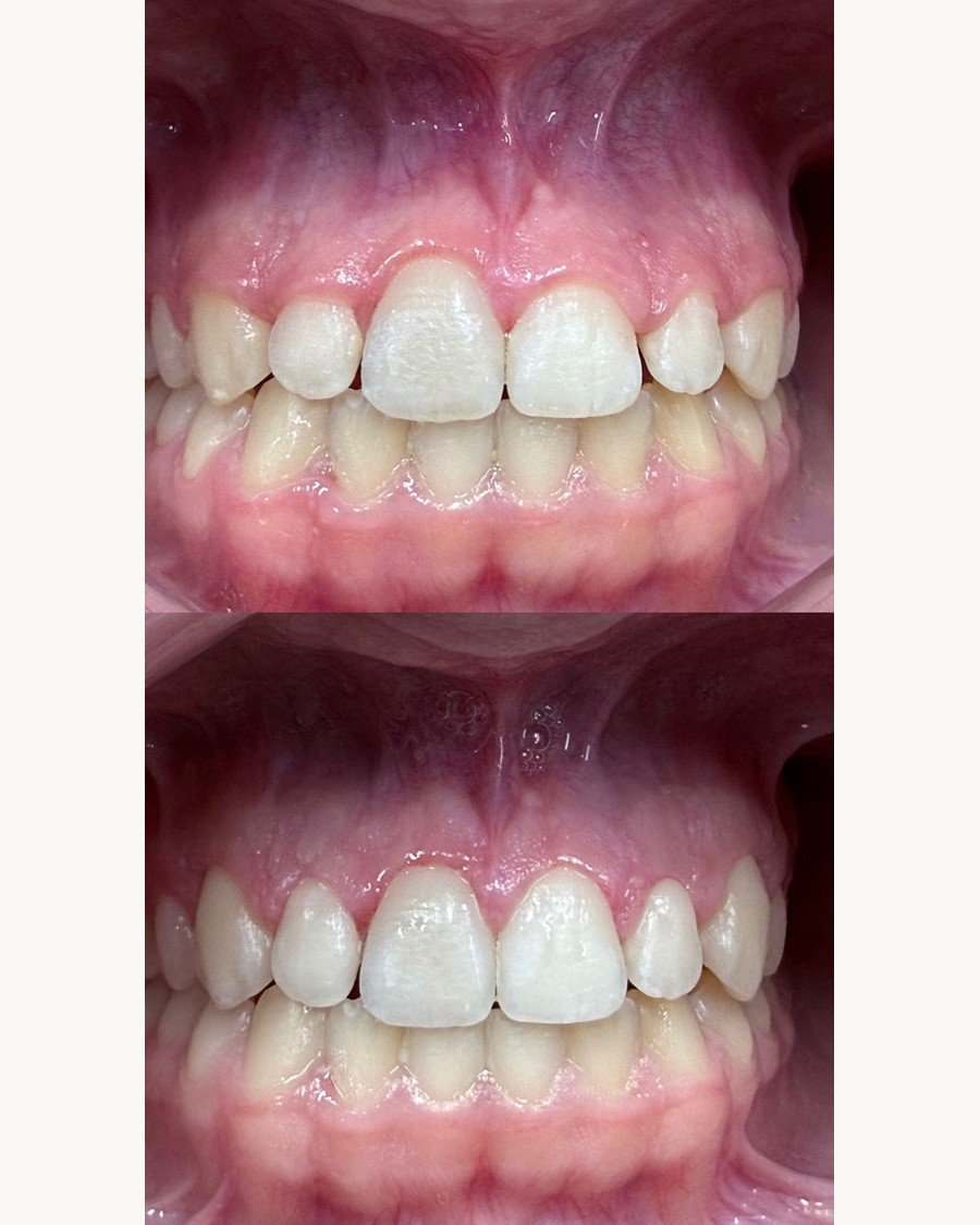 Parodontologija — Dentana Pro