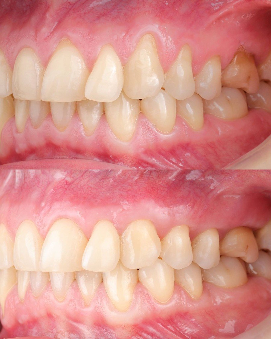 Parodontologija — Dentana Pro