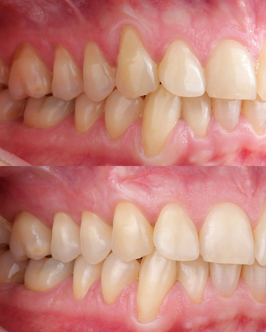 Parodontologija — Dentana Pro